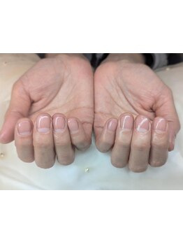 爪の悩みを解消できる（ケア含む）