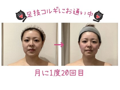 レアフィート(Rheafeet)の写真