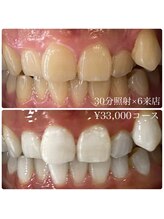 ホワイトニングルーム 横浜店(Whitening Room)/セルフホワイトニングサロン横浜