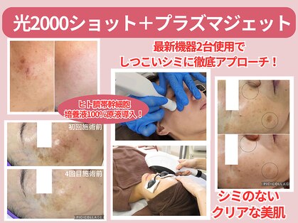 ソイ(Soi)の写真