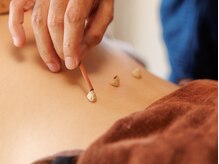 素近藤健康相談所の雰囲気(お灸で心も身体も、リラックス。)