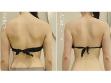 ラフォス×痩身マッサージ90分｛ 2ヶ月 8回 ｝