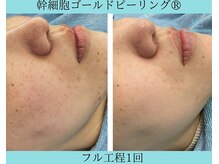 リメイククリニカルビューティー(Remake clinical beauty)/