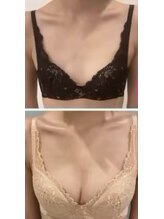 スマイルクルー(SmileClue)/ビフォーアフター症例