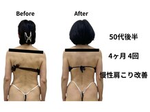 ジャジャン(jajan)/肩こりで疲れが取れない