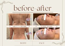 ルメリア(Lumelia)