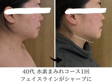 ヨサパーク タキ 上野毛(YOSA PARK TAKI)/40代・水素まみれコース/1回