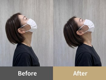 整体クオーレ 奈良新大宮店(Cuore)/Before After