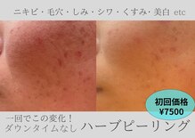 ルアーナ(Luana)