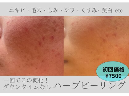ルアーナ(Luana)の写真