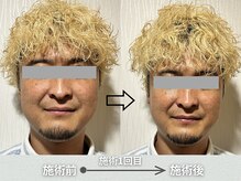実野莉/小顔整体のブフォーアフター