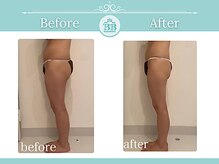 美人バスト 辻堂店/バストを残してダイエット症例