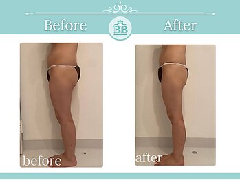 美人バスト 辻堂店/バストを残してダイエット症例