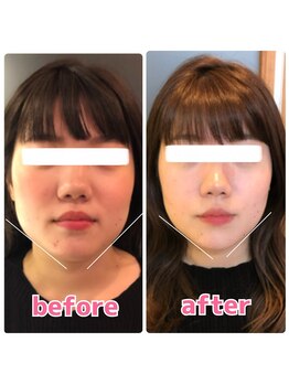 ヴィヴィアナ(viviana)/浮腫を何とかしたい！