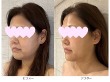 ベルメイク(BELLE MAKE)/美整コルギ☆ビフォーアフター横