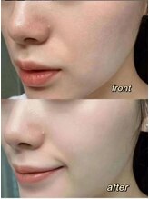 令和美/施術風景♪