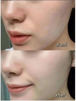 令和美/施術風景♪