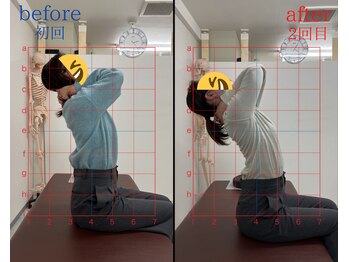 トワニ整体 新富町院(TOWANI整体)/肩こり/銀座/新富町/築地/整体