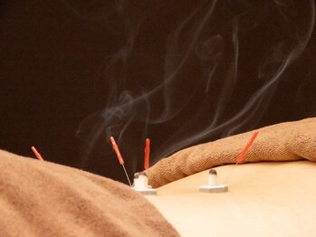 クオーレ(Cuore)/鍼灸