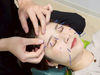 エイチワイ 白木原店(HY)の写真/目パッチリ鍼×マッサージ【¥3300】目の疲れ・重だるさにサヨナラ!目の周りを集中的にケア★眼精疲労にも◎