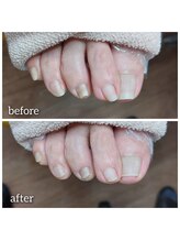 爪切り屋 足楽/