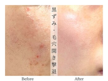 リララ(lelala)/ビフォーアフター☆