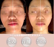 美骨小顔サロン アビー(ABBY)