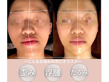 美骨小顔サロン アビー(ABBY)