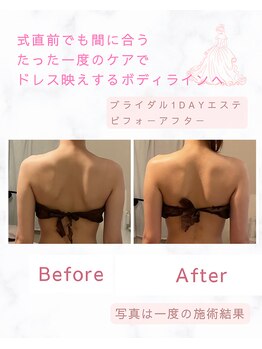 ティアラ(Tiara)/