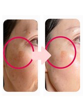 イシスビューティー/パッと明るい透明感肌へ