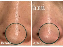 フジモトサロン 那覇おもろまち店(fujimotoサロン)/韓国肌管理/白玉肌/水光肌へ★