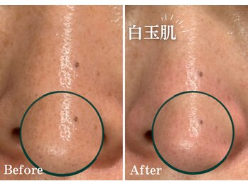 フジモトサロン 那覇おもろまち店(fujimotoサロン)/韓国肌管理/白玉肌/水光肌へ★