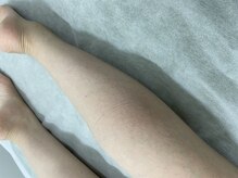 ナノハナ/鹿沼市全身脱毛美容室ナノハナ