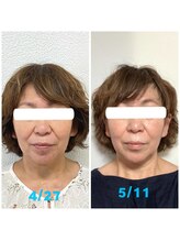 ビューティスタジオＫ/顔周りタルミの改善フェイシャル