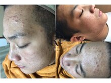 リー ビューティースパ 川崎(Ri beauty spa)/サービスを利用する前