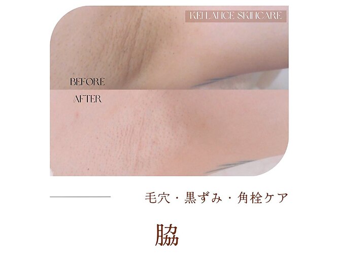 ミークチュール(me couture)｜ホットペッパービューティー
