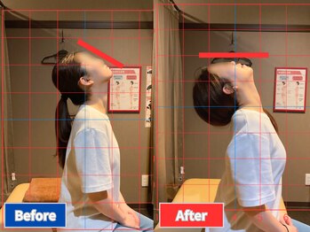 ナオル整体 仙台院(NAORU整体)/首が苦しくて頭痛が…