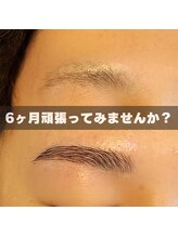 メリーロウ(meryllow)/初回来店からの変化