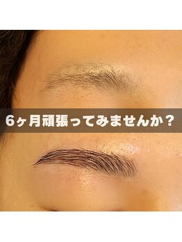 メリーロウ(meryllow)/初回来店からの変化