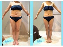 千歳の女神 岡崎店/【施術風景】Before/After