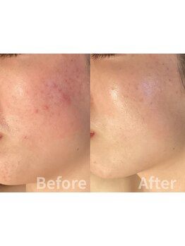 お肌をきれいにしたい