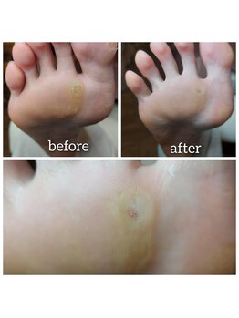 爪切り屋 足楽/