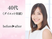 整体院カイト/40代/ビフォーアフター