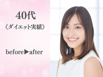 整体院カイト/40代/ビフォーアフター