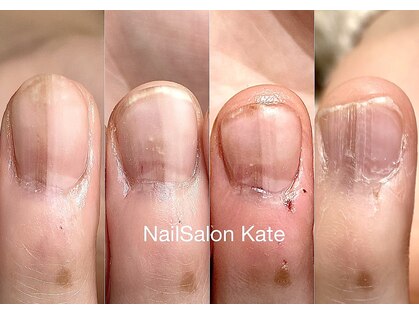 プライベートネイルサロン ケイト(Kate)の写真
