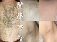 ヴィーダ 渋谷松濤(ViDA)