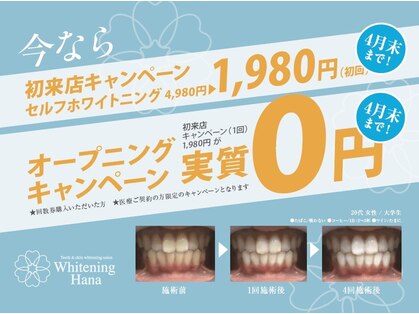ホワイトニング ハナ 南本町店(WHITENING HANA)の写真