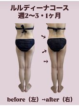 ヨサパーク リアン(YOSA PARK Lien)/モニター様before→after