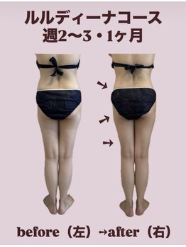 ヨサパーク リアン(YOSA PARK Lien)/モニター様before→after
