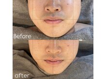 メンズエムボーテ 太田店(Men's M BEAUTE33)/【顔筋小顔コルギ】